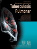 Manual para la enseñanza en la atención de la Tuberculosis Pulmonar
